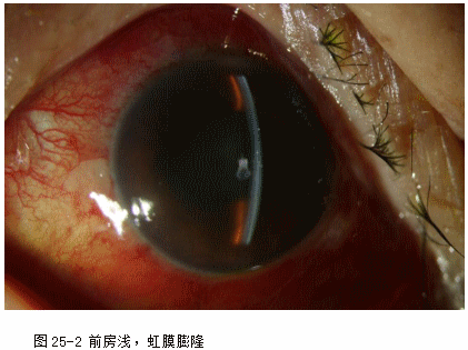 ZY016_130_2.gif